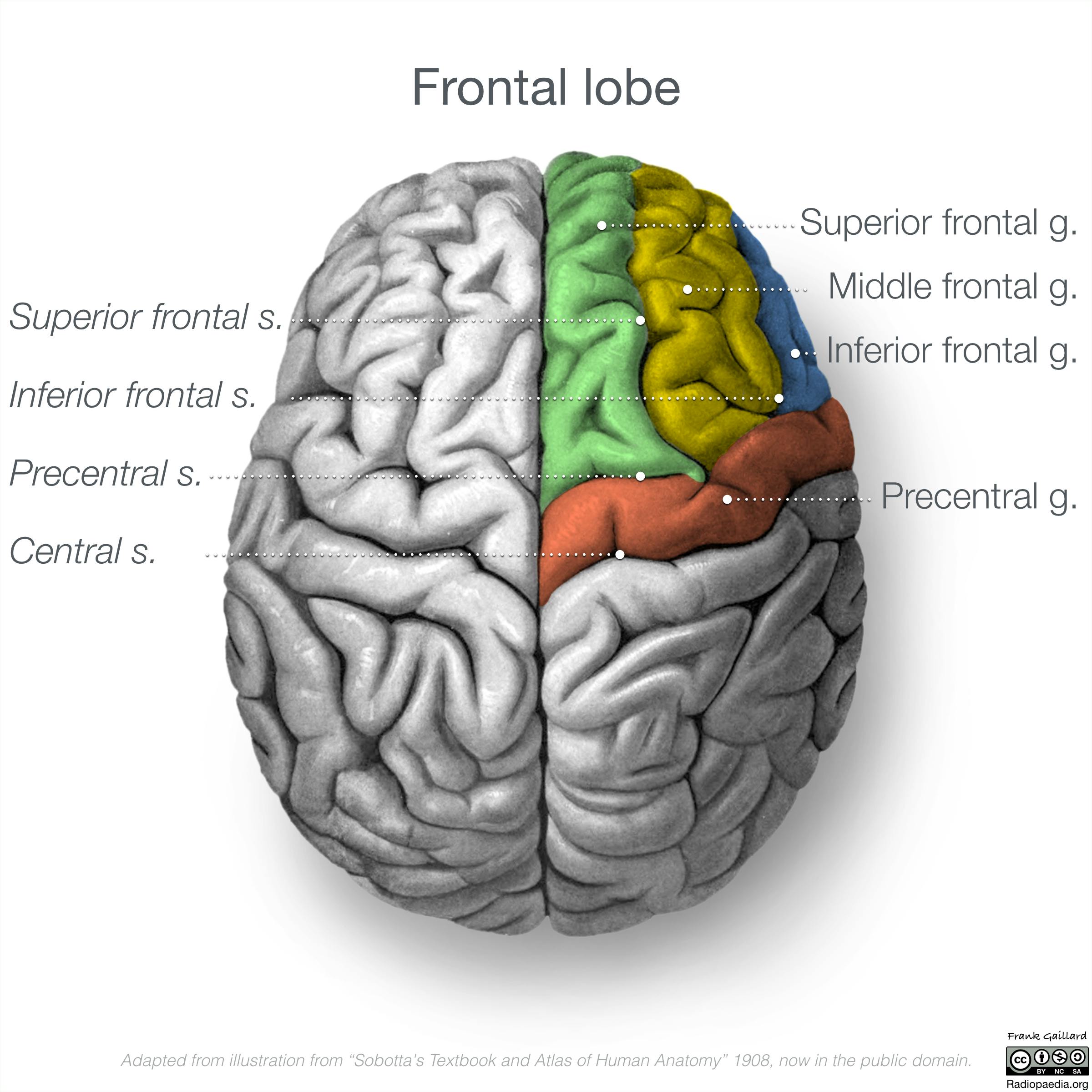 Frontal Lobe | SpeechFit